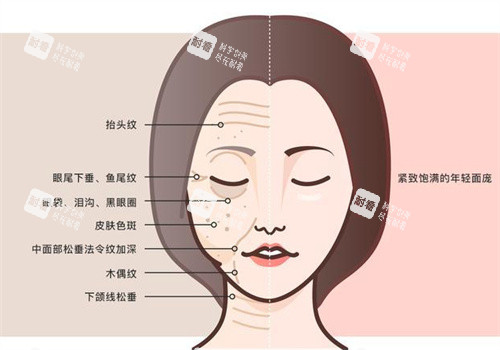 面部抗衰前后.jpg 面部抗衰前后.jpg