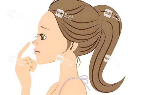 鼻部整形.png 鼻部整形.png