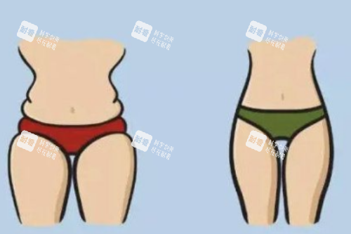 腿部吸脂对比图.png 腿部吸脂对比图.png