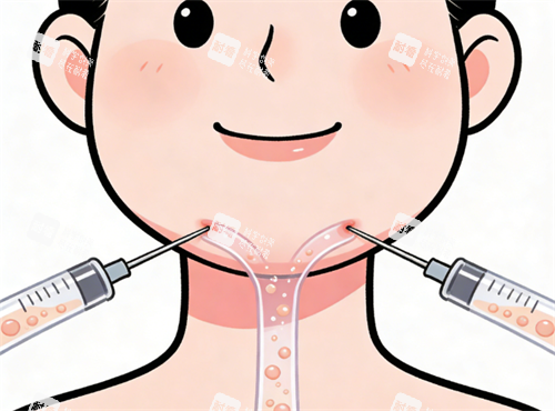 面部吸脂示意图.png 面部吸脂示意图.png