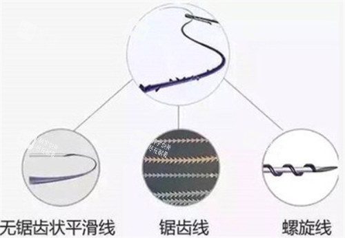 埋线提升不同类型的线.jpg 埋线提升不同类型的线.jpg