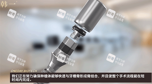 韩一种植体示意图.png 韩一种植体示意图.png