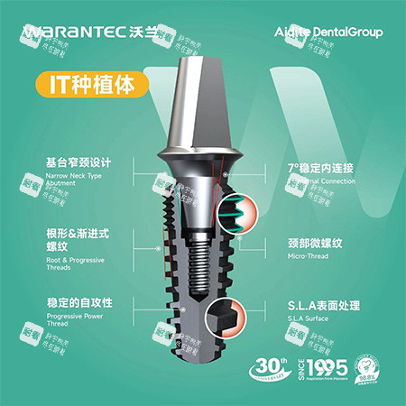 沃兰种植牙IT型号照片.jpg 沃兰种植牙IT型号照片.jpg