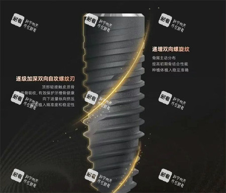 卡尔斯种植牙种植体螺纹照片.jpg 卡尔斯种植牙种植体螺纹照片.jpg