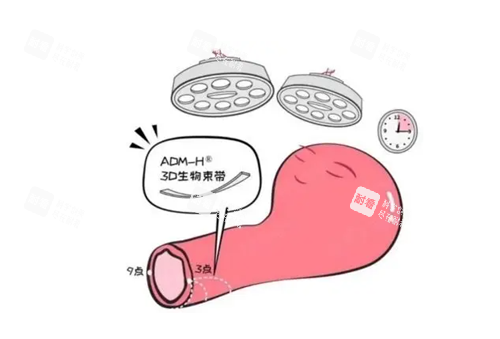3d生物束带缩阴.png 3d生物束带缩阴.png