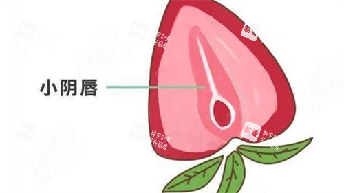小阴唇整形.jpg 小阴唇整形.jpg