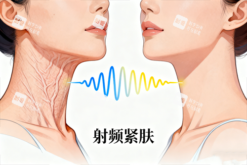 射频紧肤前后对比图.png 射频紧肤前后对比图.png