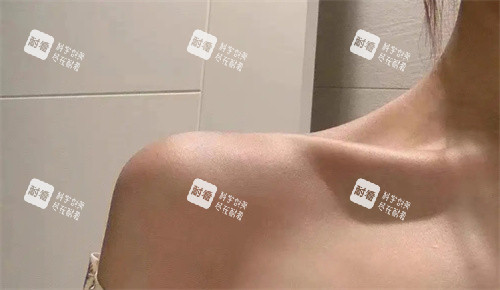 直角肩注射后照片.jpg 直角肩注射后照片.jpg