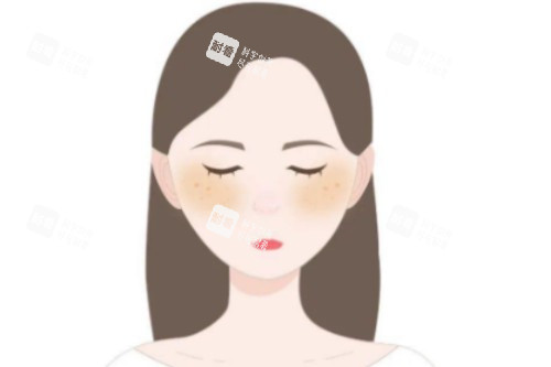 皮肤暗沉发黄卡通图 皮肤暗沉发黄卡通图