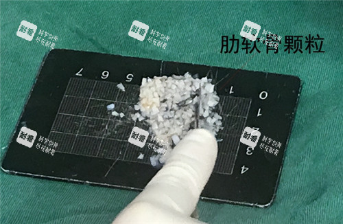 肋骨碎填充鼻基底材料.jpg 肋骨碎填充鼻基底材料.jpg
