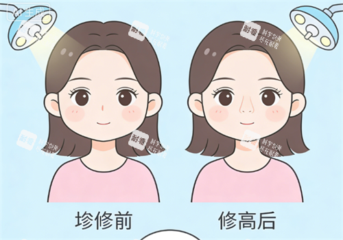 鼻修复前后的对比.png 鼻修复前后的对比.png