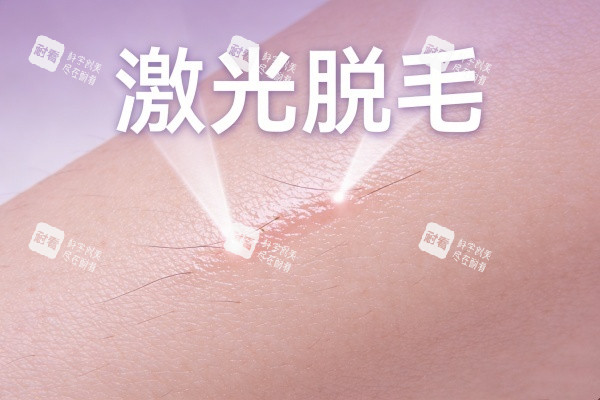 激光脱毛卡通展示图.jpg 激光脱毛卡通展示图.jpg
