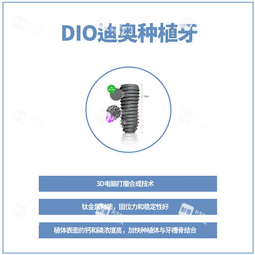 韩国DIO种植牙讲解图.jpg 韩国DIO种植牙讲解图.jpg