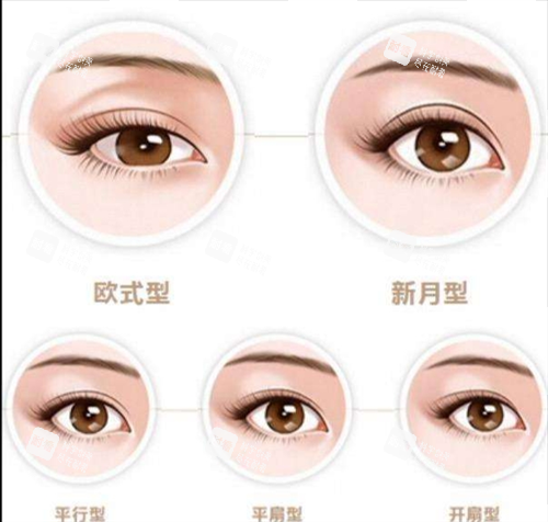 双眼皮类型图示.png 双眼皮类型图示.png