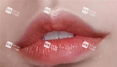 微笑唇照片.jpg