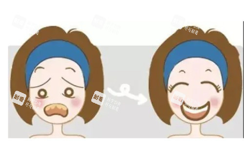 牙齿美白卡通图片一览.jpg 牙齿美白卡通图片一览.jpg