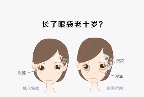 祛眼袋对比.webp.jpg