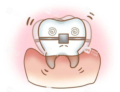 牙齿矫正松动.webp.png