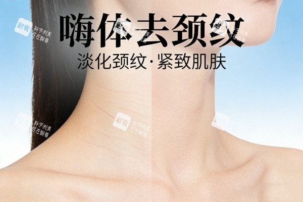嗨体去颈纹卡通展示图.jpg