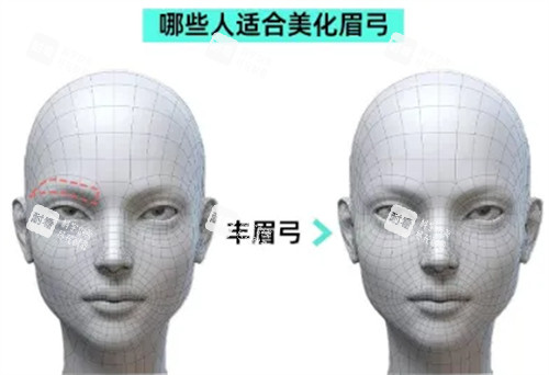 哪些人适合做眉弓整形.jpg 哪些人适合做眉弓整形.jpg
