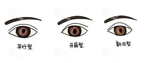 双眼皮.jpg 双眼皮.jpg