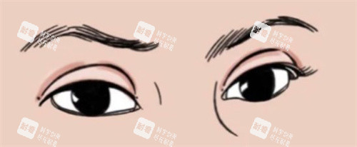 双眼皮肉条感.jpg
