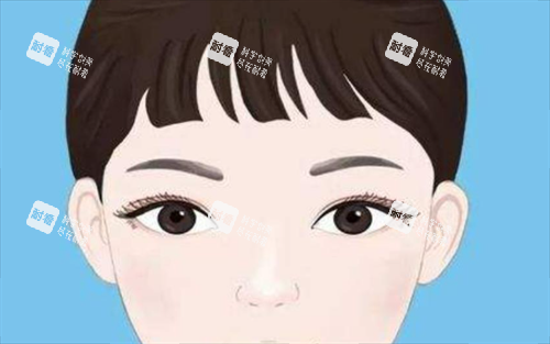 双眼皮展示.png