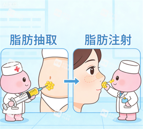 脂肪移植过程.png 脂肪移植过程.png