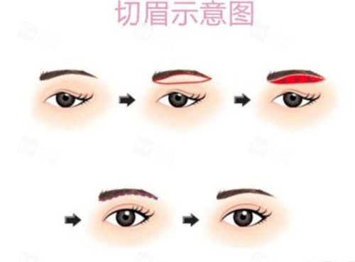 提眉.jpg