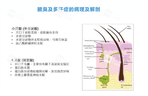 腋臭怎么办.jpg 腋臭怎么办.jpg