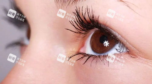 眼周年轻化.webp.jpg 眼周年轻化.webp.jpg