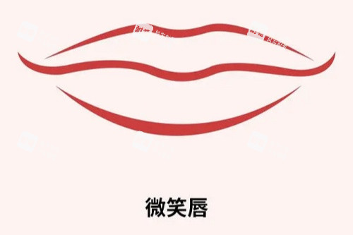 微笑唇展示图.jpg 微笑唇展示图.jpg