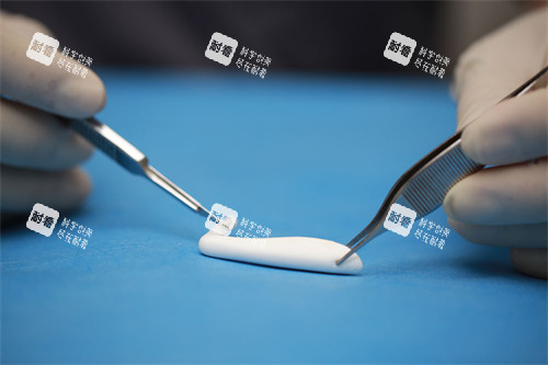 隆鼻手术中使用的膨体.jpg 隆鼻手术中使用的膨体.jpg