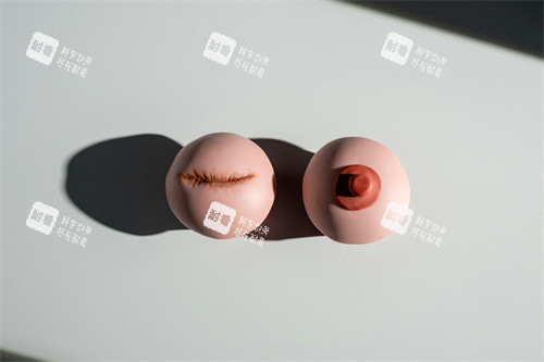 乳晕手术整形展示图.jpg 乳晕手术整形展示图.jpg
