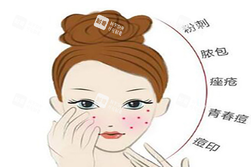 激光美肤适应症.jpg 激光美肤适应症.jpg