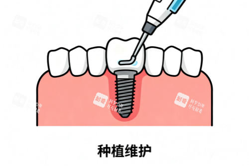 种植牙维护卡通图.png 种植牙维护卡通图.png