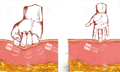 双逆博士作用皮肤组织动画展示图.png