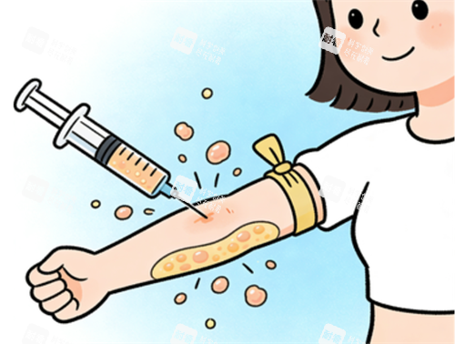 手臂吸脂过程图.png 手臂吸脂过程图.png