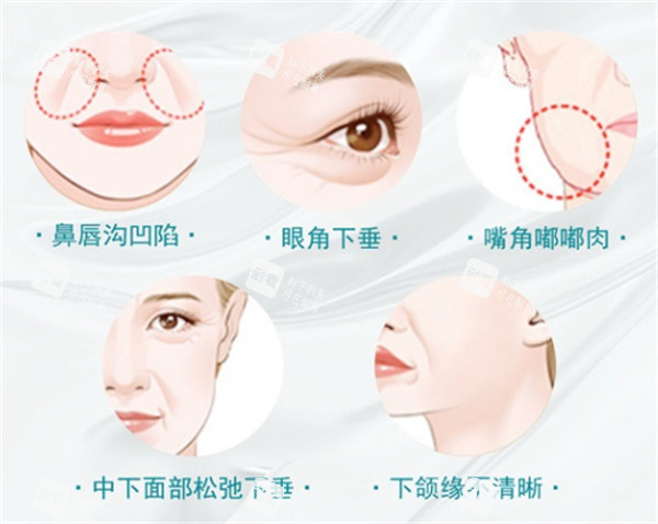 皱纹的类型.jpg 皱纹的类型.jpg