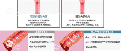 韩国信所爱女性医院生物束带技术.jpg 韩国信所爱女性医院生物束带技术.jpg