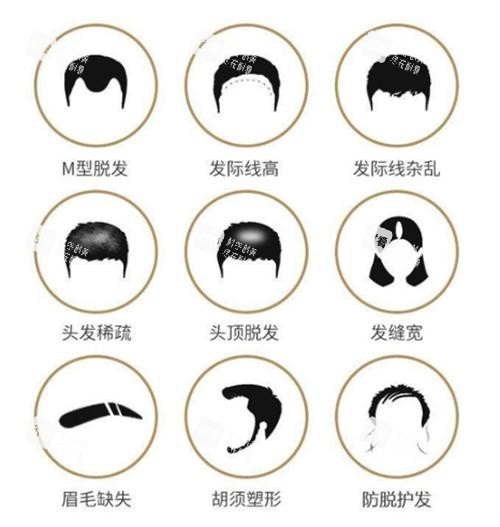 各种需要植发的情况图.png 各种需要植发的情况图.png
