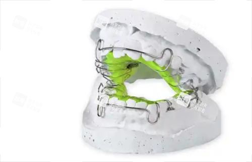 牙齿矫正扩弓器.png