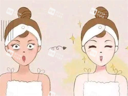 光子嫩肤前后的对比.jpg