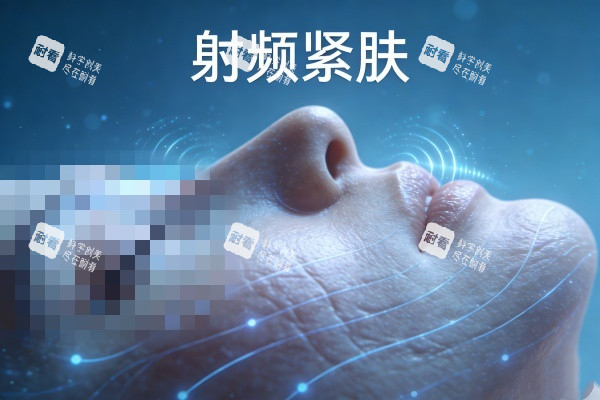 射频紧肤卡通图展示.jpg