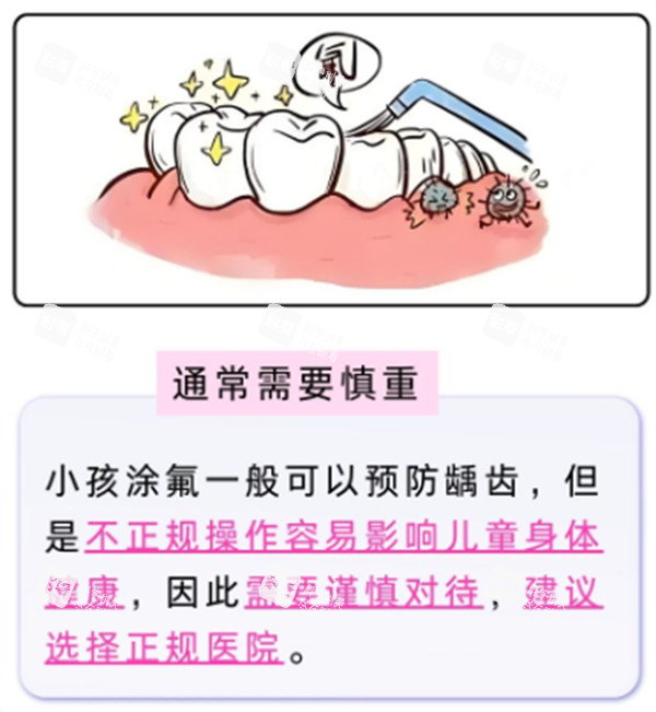 牙面涂氟注意点.jpg 牙面涂氟注意点.jpg