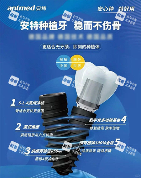 安特种植牙莫氏锥度照片.jpg