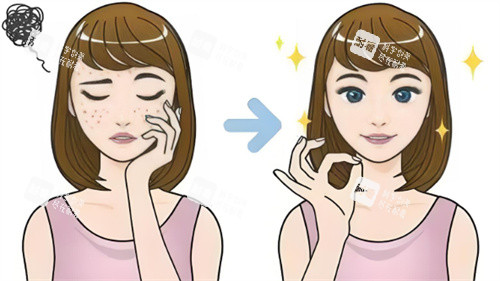 去痘印前后对比.jpg