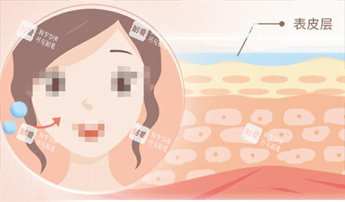 玻尿酸面部注射动画以及皮肤表面.png 玻尿酸面部注射动画以及皮肤表面.png