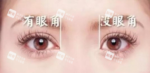 有没眼角区别.jpg 有没眼角区别.jpg