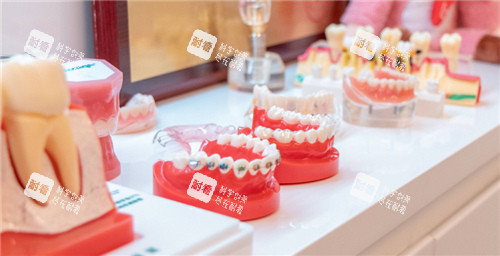 牙套牙模展示.jpg 牙套牙模展示.jpg